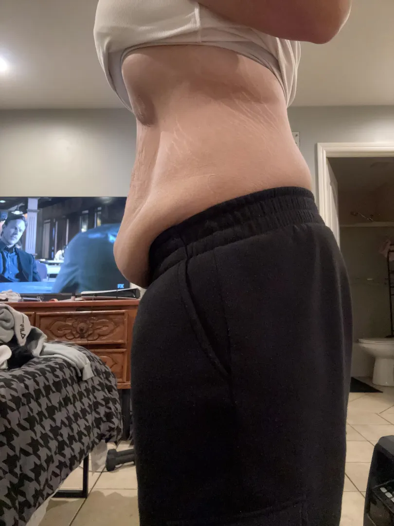 Started at 227 currently 182 so much more to go hopefully one day I can get surgery to feel my best