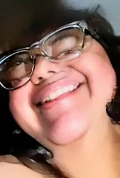 The glasses make me look like a bug