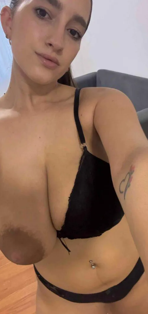 What's the score of my dark areolas