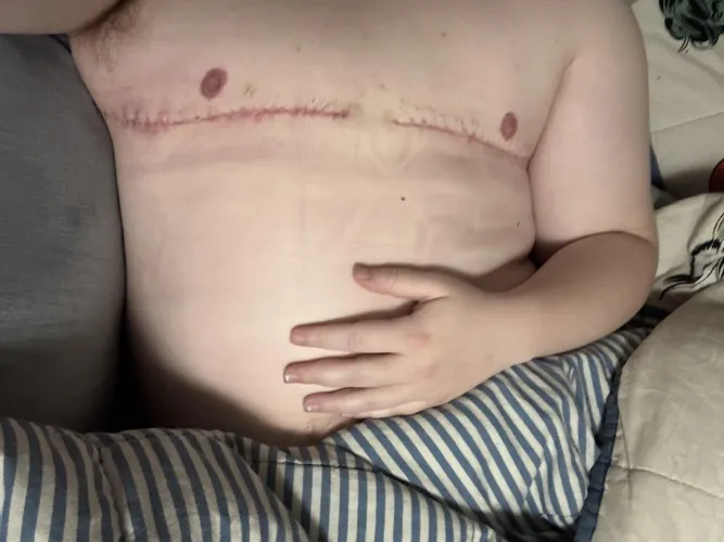 1 month PO and feeling sexy