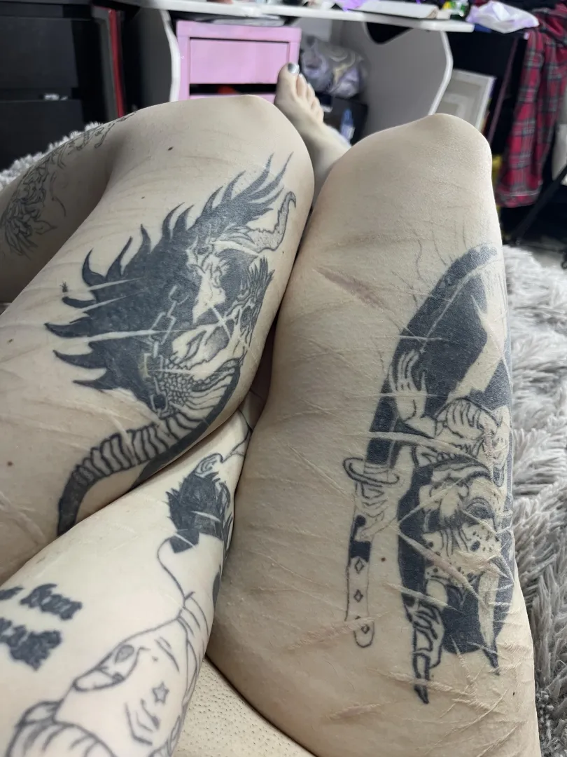 aesthetics in scars n tattoos..