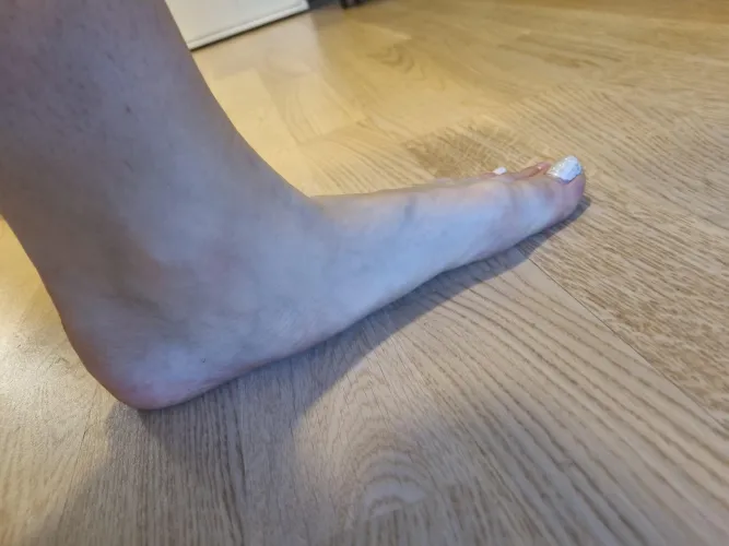 Anyone interested in flat feet?
