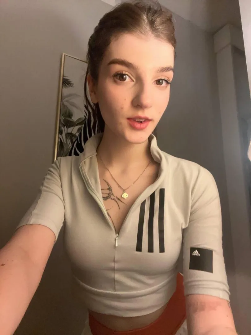 braces got me feeling cute or what?