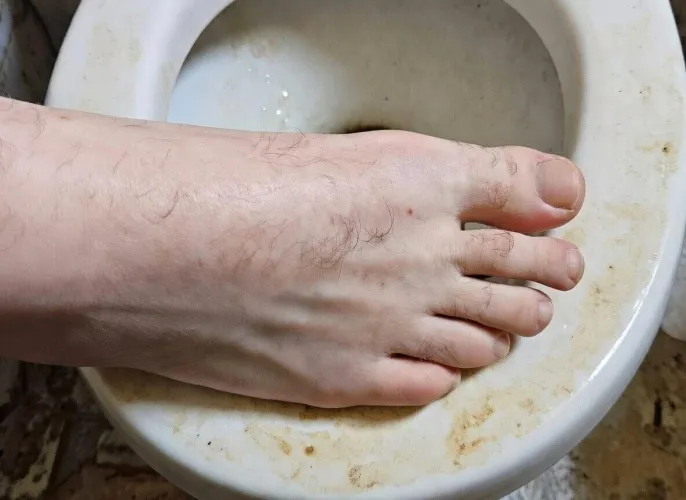 Pure skin. Wrong place.