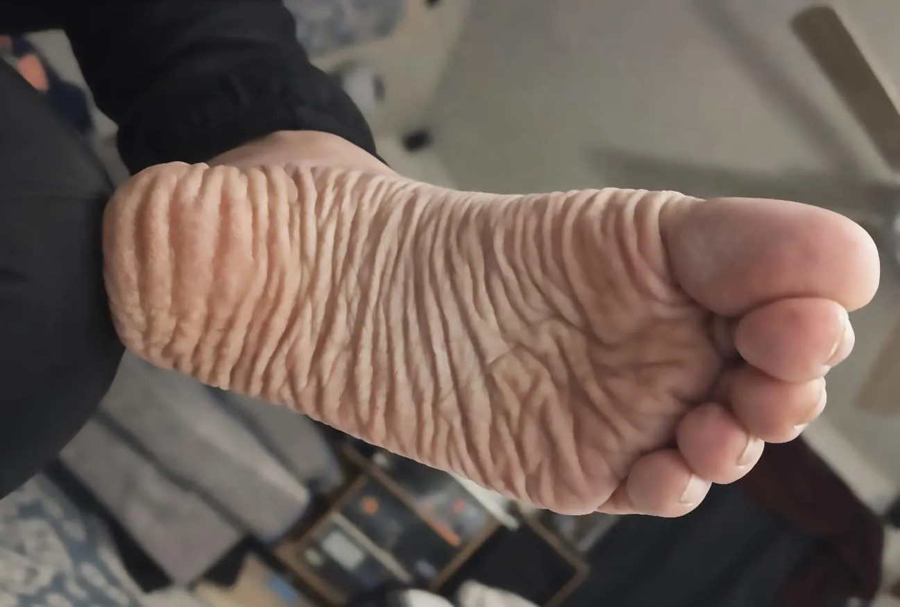 deep wrinkled heel soles