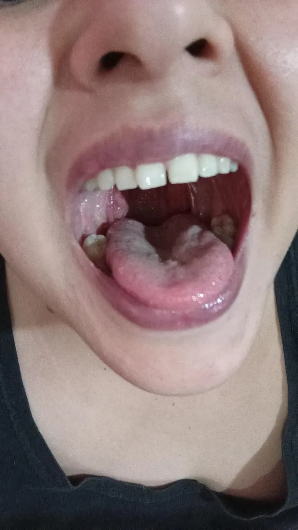 You'll be perfectly safe in here unless I forget not to swallow you