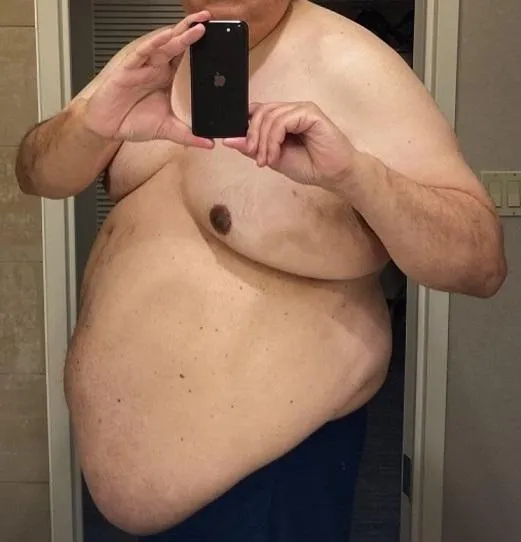 62 [M4F] #San Francisco - Are you a WOMAN seeking humiliation & degradation? If so, then this Fat, Ugly, Old Pervert is just what the doctor ordered! NOTE: I’M LOOKING FOR WOMEN IN THE SAN FRANCISCO BAY AREA ONLY FOR REAL-TIME PLAY. I’M NOT INTER