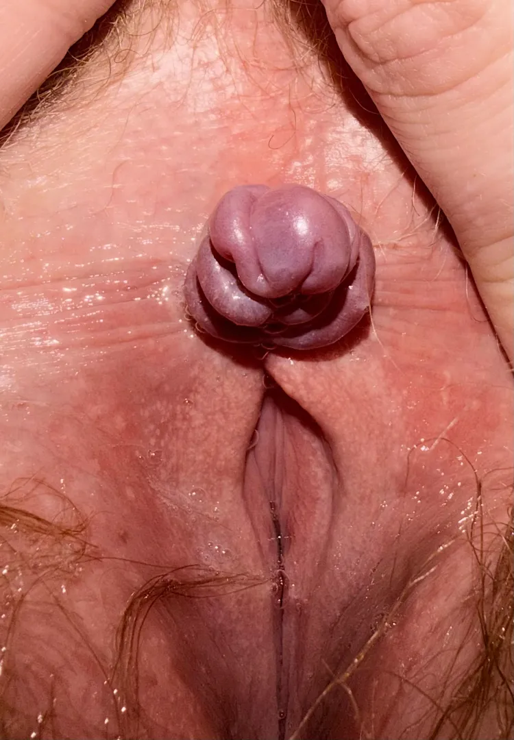 My poor tied clitty 