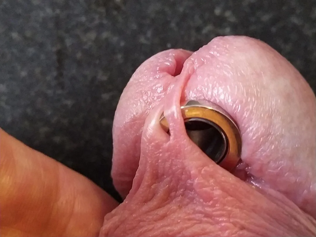 What with the frenulum