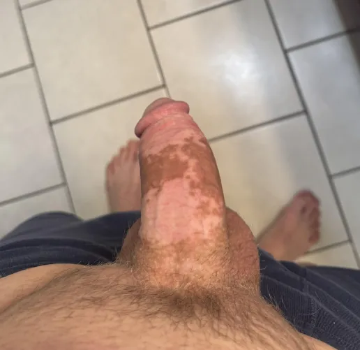 First post. So spotty