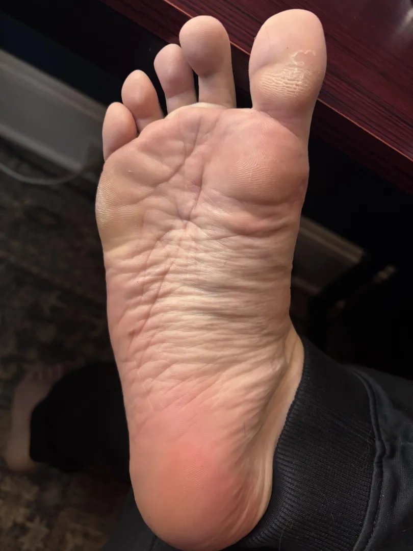 Winter’s been tough on these