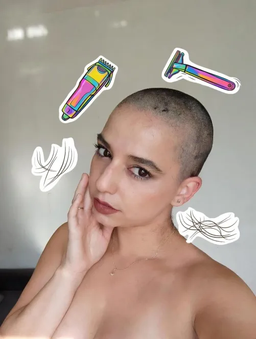 Bald is beautiful. Never forget that.