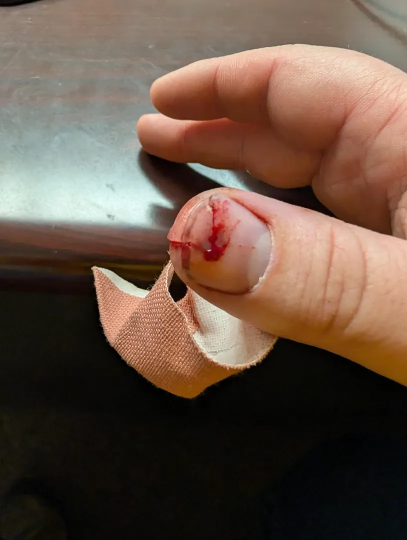 Cut finger from a tree branch
