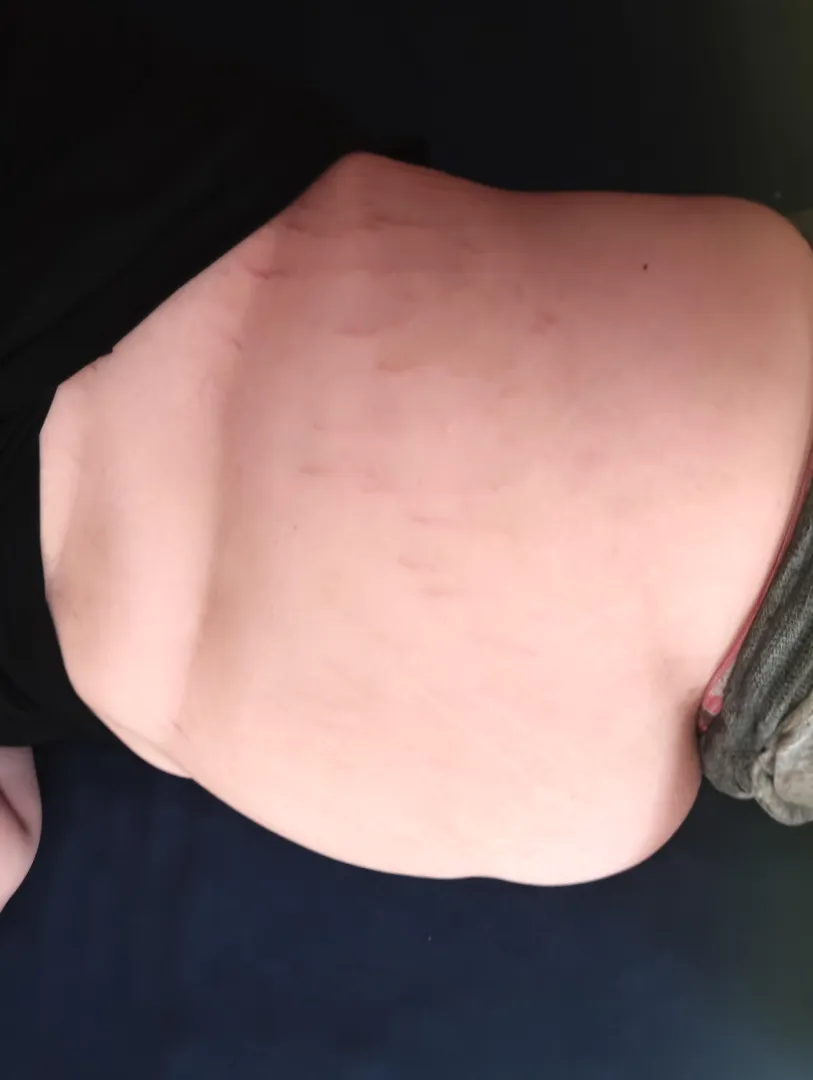 what shape fo you think my belly will become?