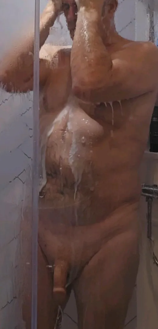 3 years old scar now [58]