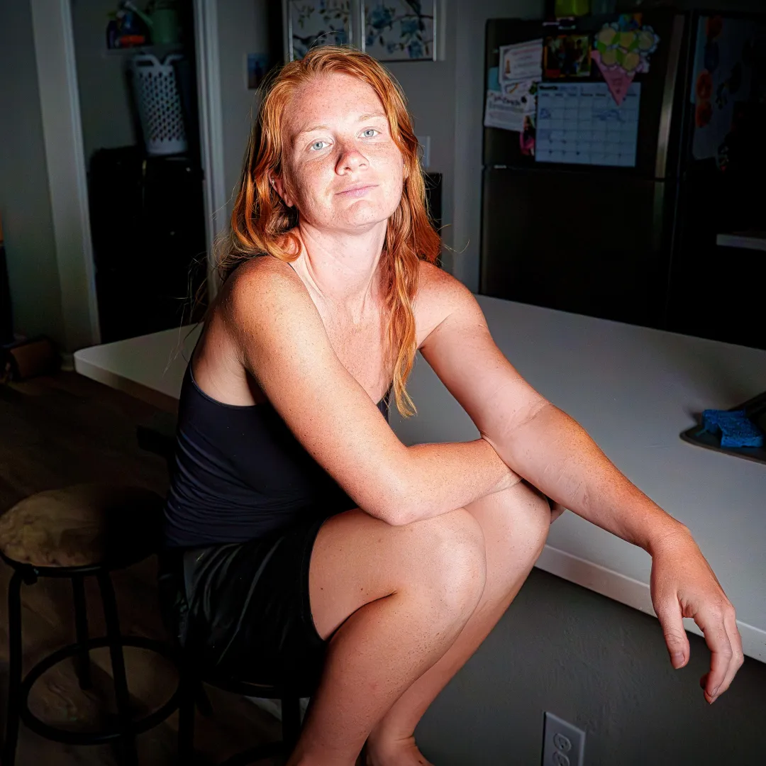 freckles like fireworks--light up when you stare [Return Our 3P Tools/Apps]