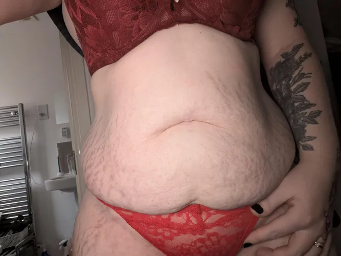 The strechmarks are more prominent if I use the flash on my camera