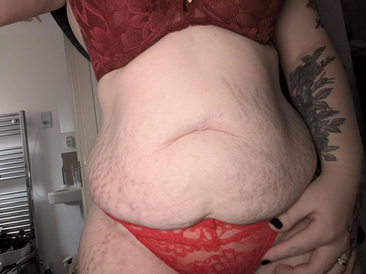 The strechmarks are more prominent if I use the flash on my camera