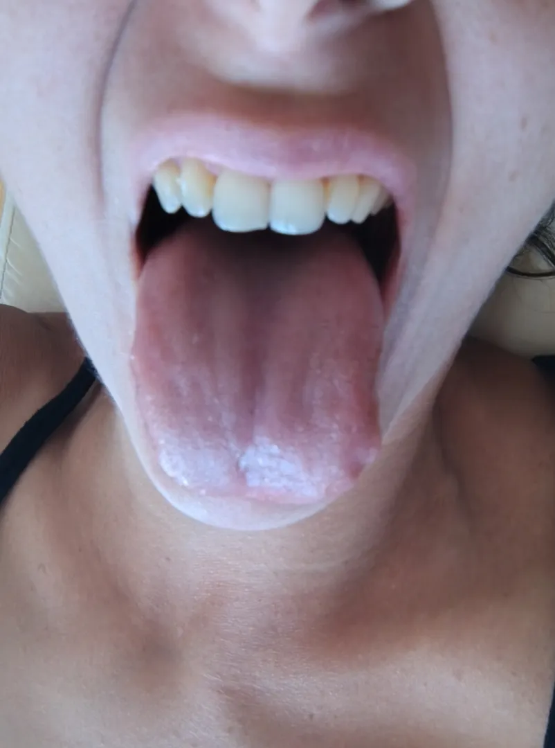 Use my tongue as a ladder