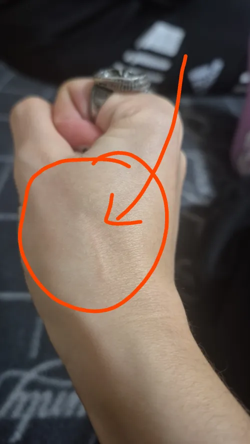 [21F] Scratch or something else? It suddenly appeared on my hand and don't know what caused it.