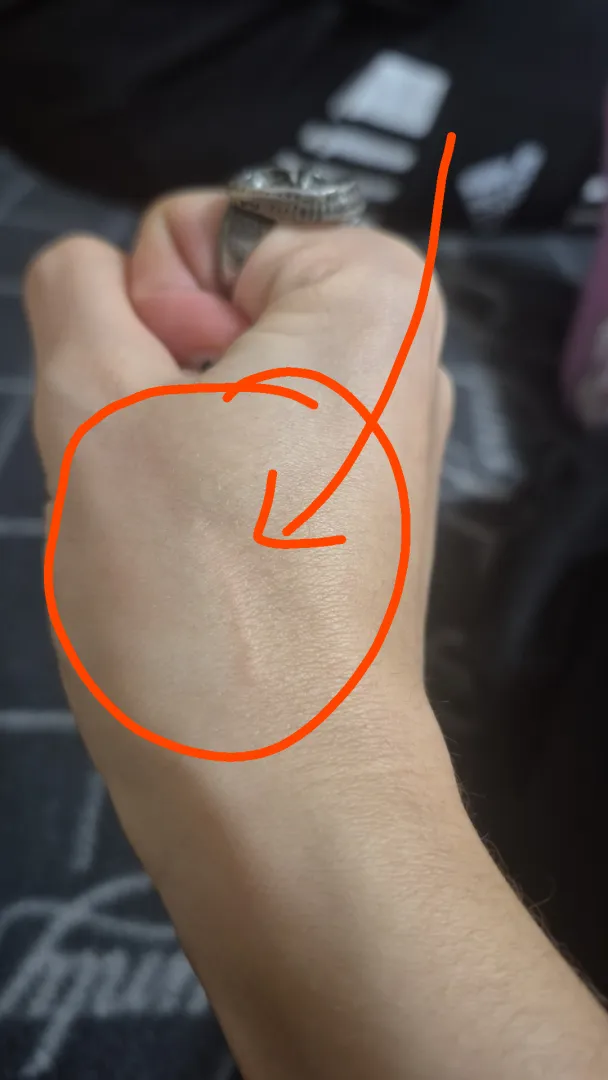 [21F] Scratch or something else? It suddenly appeared on my hand and don't know what caused it.