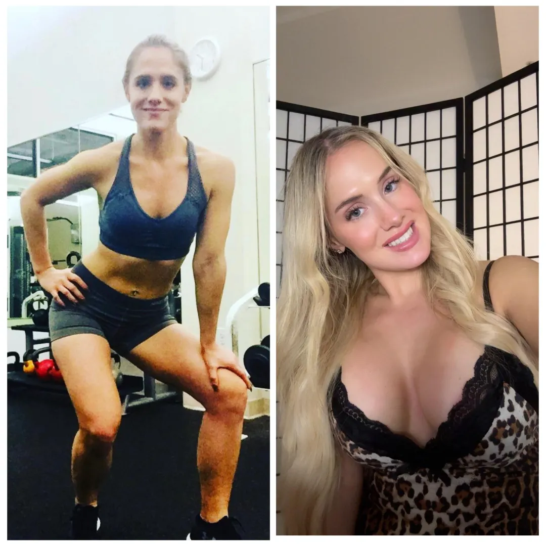 Cute then, hot now. More lip fillers next week and finally booked bigger implants and lipo 360/ab etching for the spring! Pumping up and snatching activated.