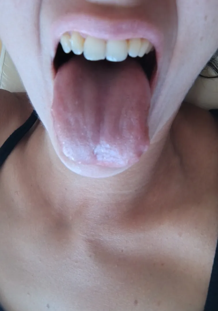 Use my tongue as a ladder {f}