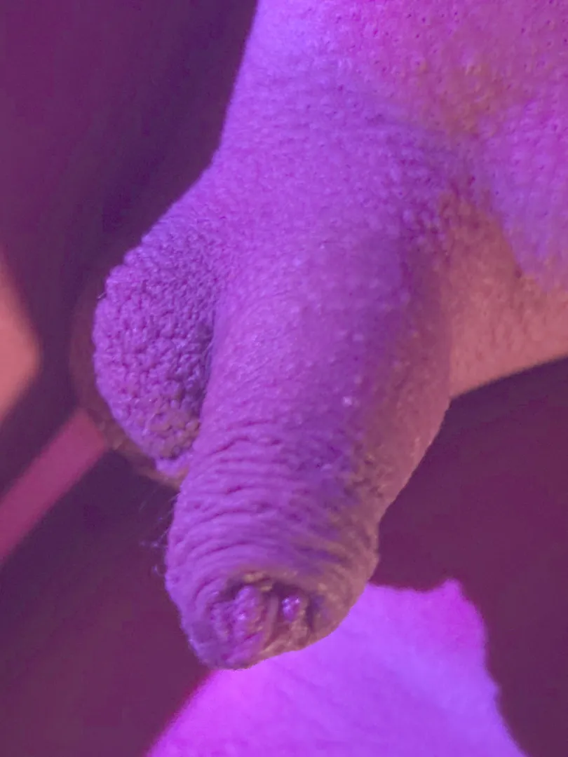 [18]Lets chat or sumthing