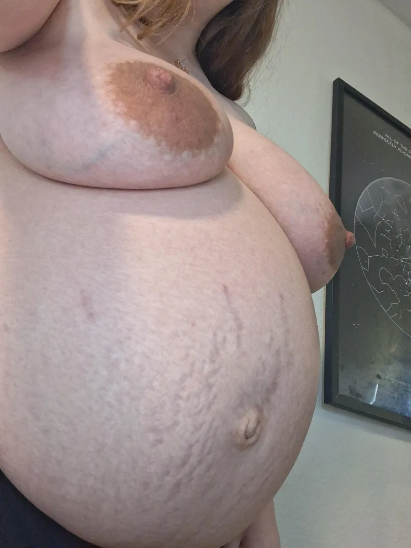 Do you like my stretch marks?