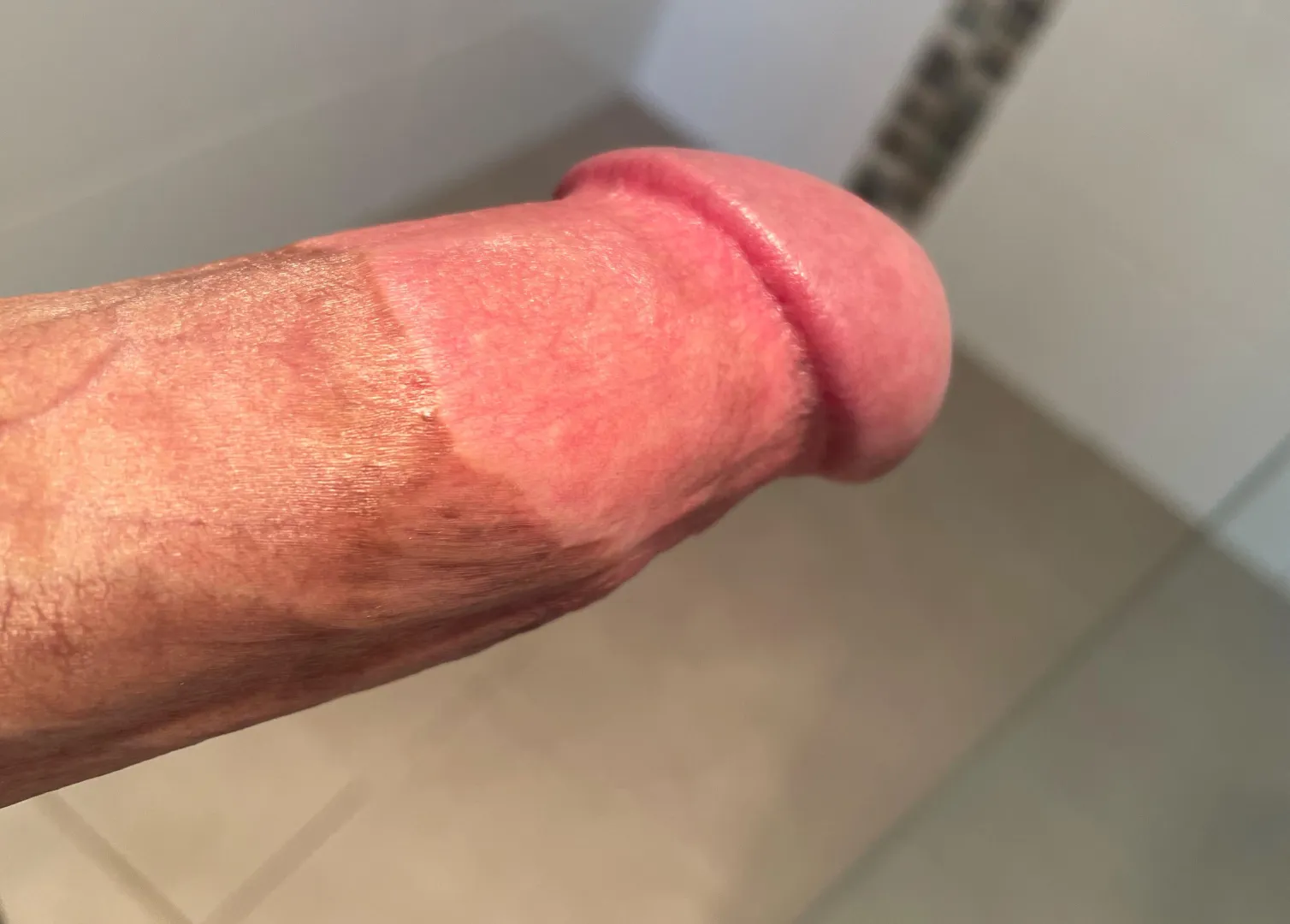 Proud every time I look down and see my crazy tight circumcision scar from when I let someone cut all of my foreskin and frenulum off!