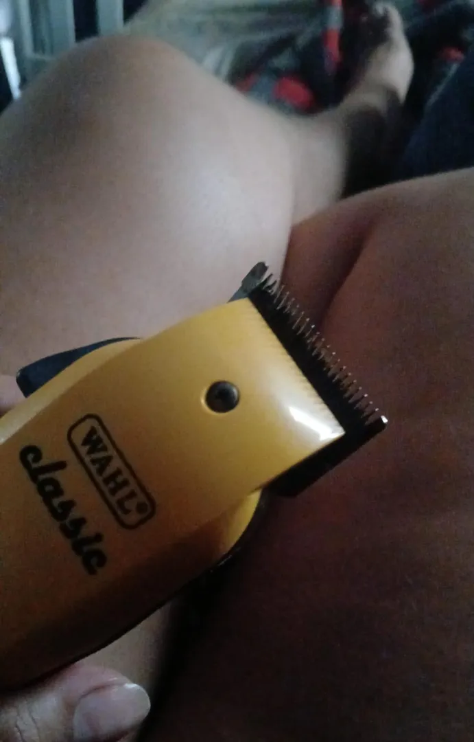 Thinking about getting smooth skin