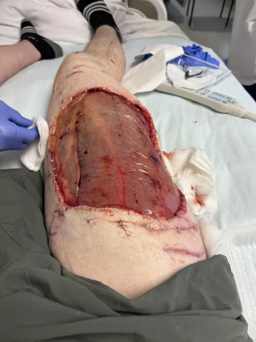 Wolverine Stack *Graphic*