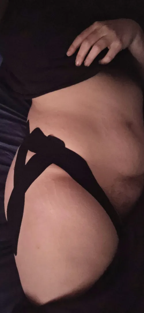 (F33 EDS) I'm still cute even though I'm taped up for yet another injury.