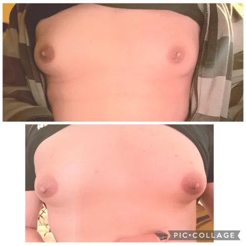 Areola changes in 13 days. Top image taken February 6, bottom image February 20. 4 months total hrt on February 23rd. Started October 23rd 2025 at 34 years old.