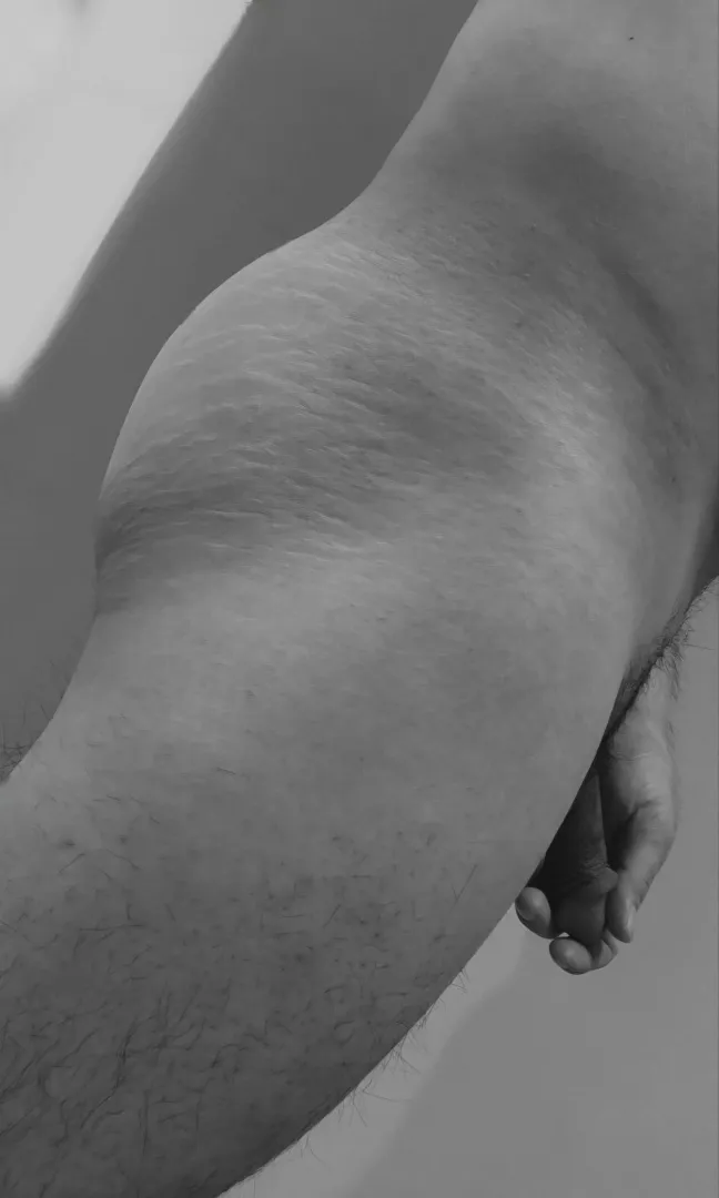 Can you see the scar 