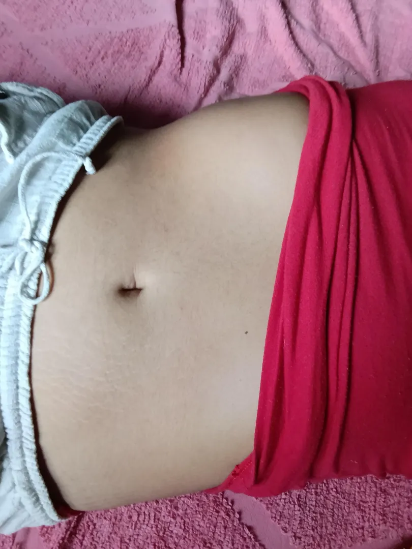 I have a lot of stretch marks here