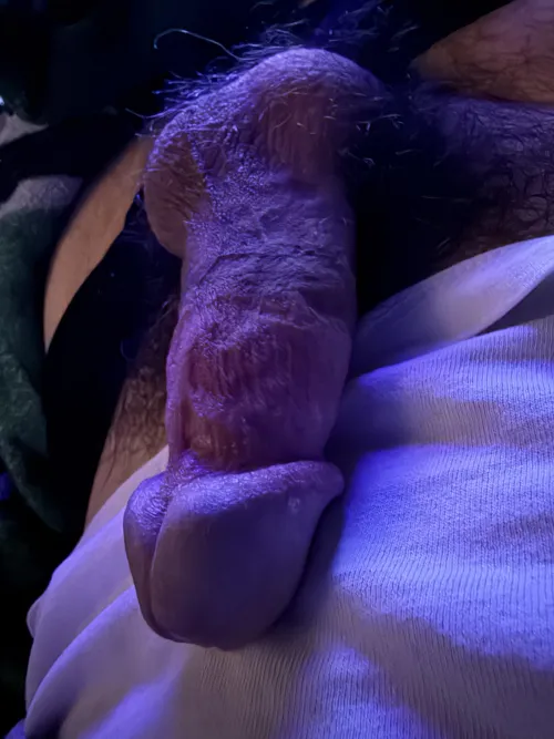 Melb dad cut at birth