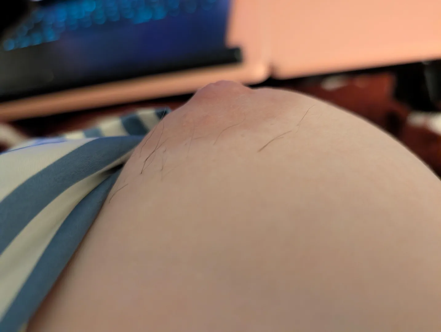 My nipple hairs grow so dark