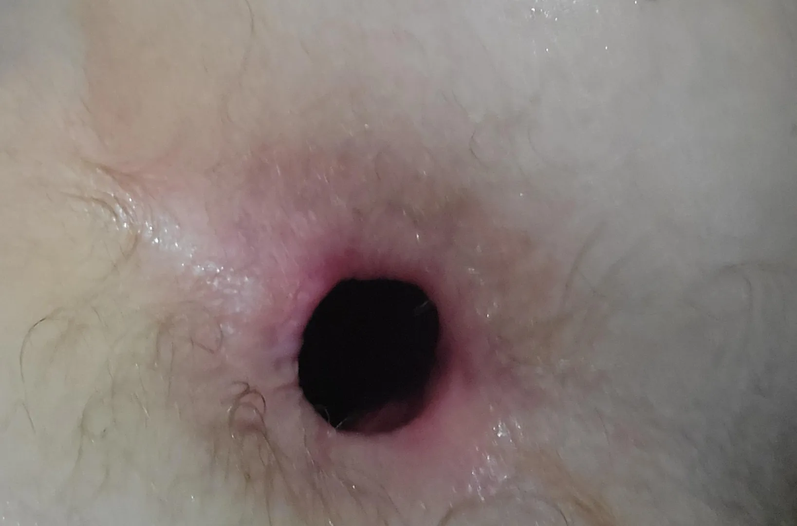 How's my gape ?