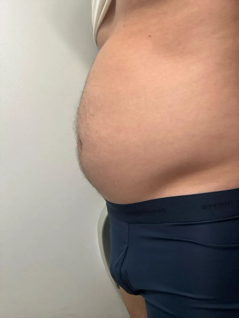 Just started gaining and most of it goes to my belly. Do women like beer bellied guys?