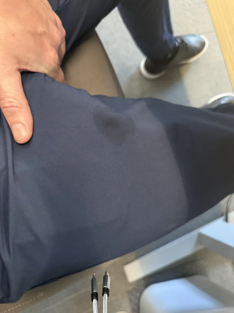 This spot keeps appearing…