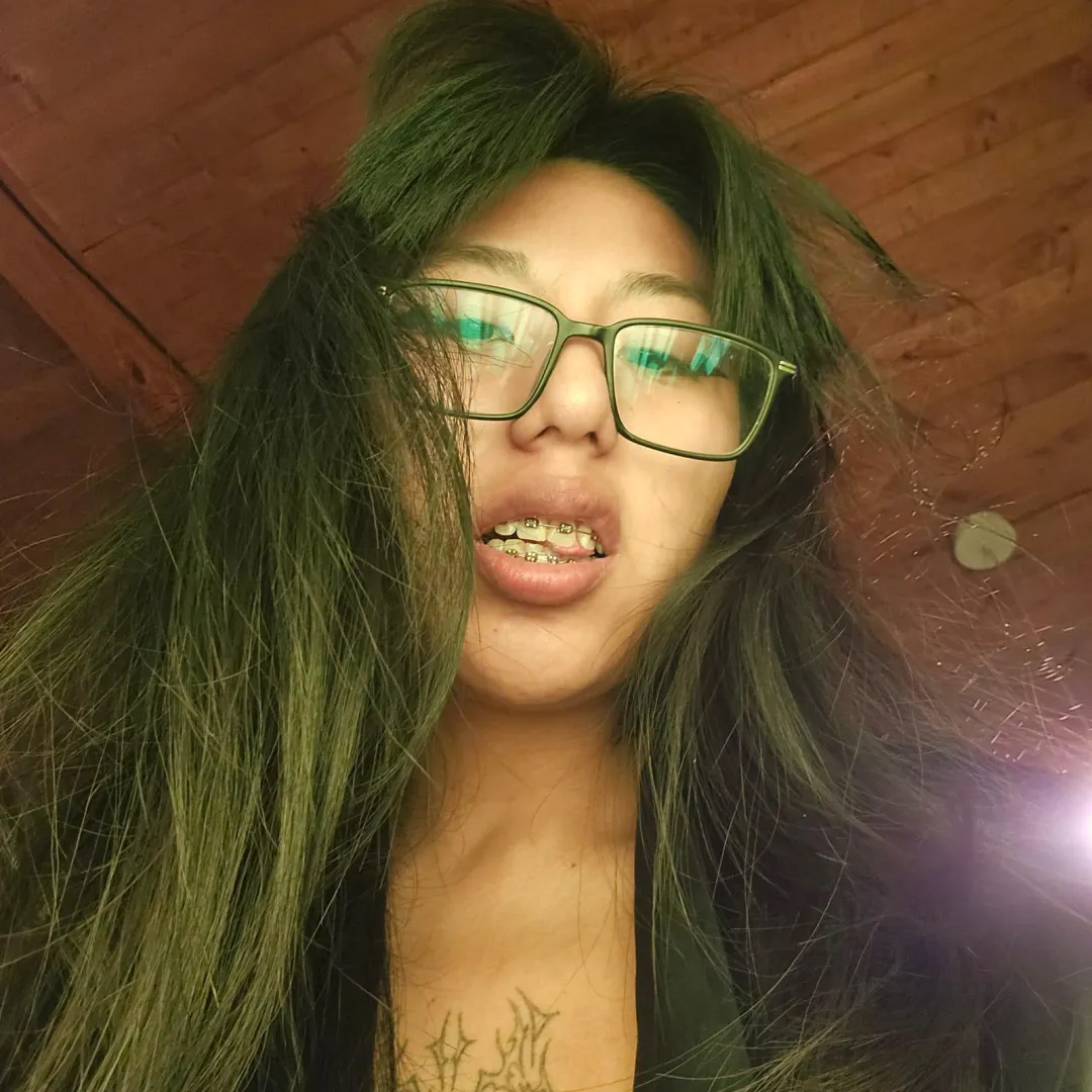 I know you are staring at my mouth and wondering how these wires would feel if I let you get close