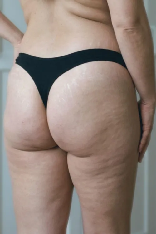 Mommy's back side [40]