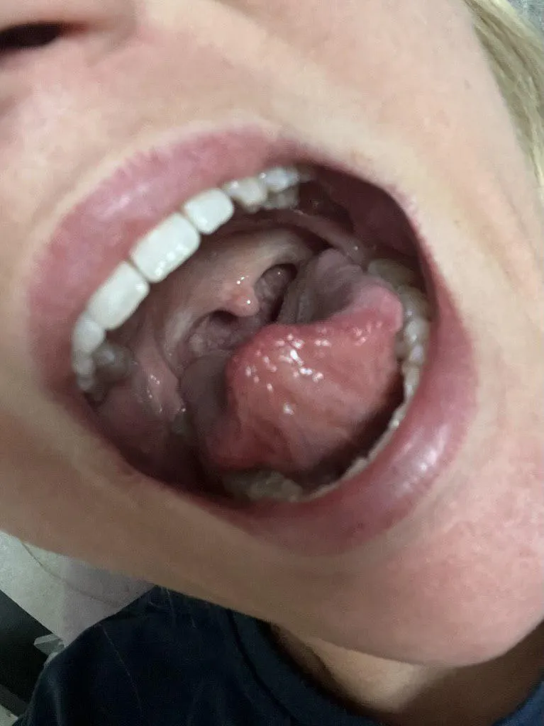 Tongue’s out… now guess where it goes next