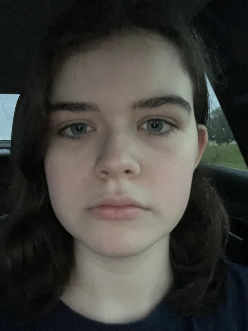 F18