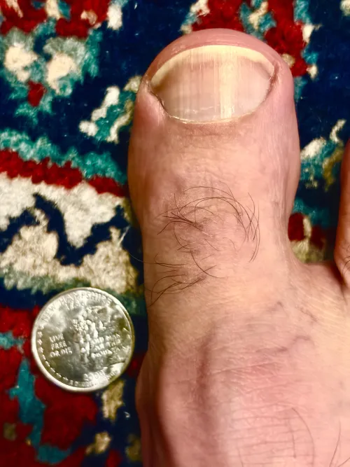 Hairy toe