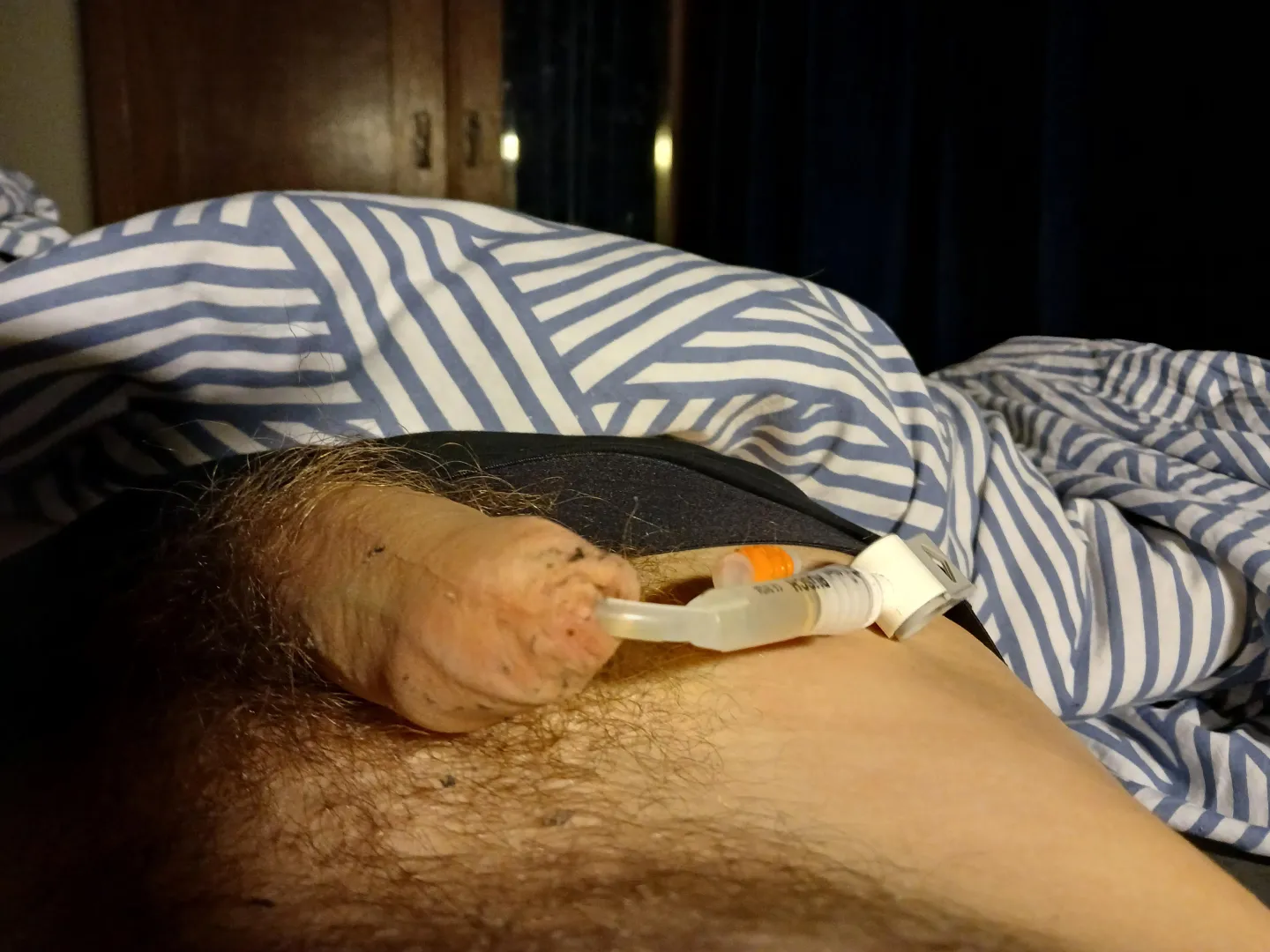 Its resting in can not smaller now whit the big tube