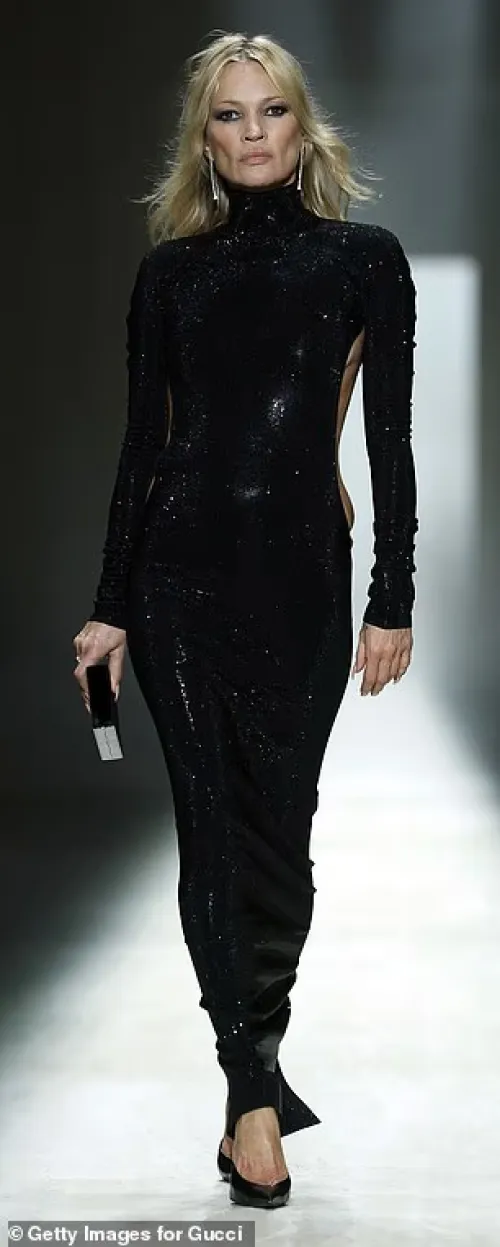 Another victim of buccal fat removal?