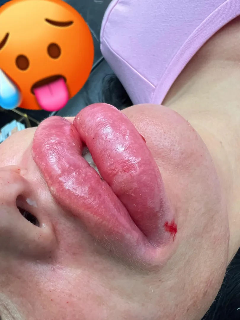 Live heute Abend 20 uhr mit neuen dicken Lippen