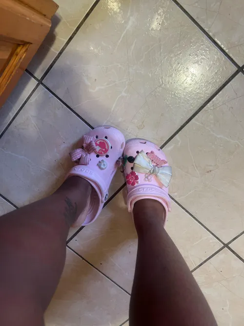 Woke up with swollen ankles 